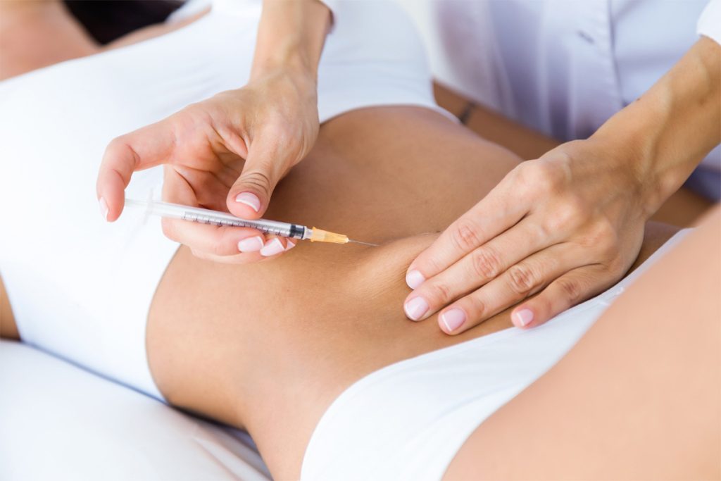 Infiltrazione estetica di mesoterapia corpo