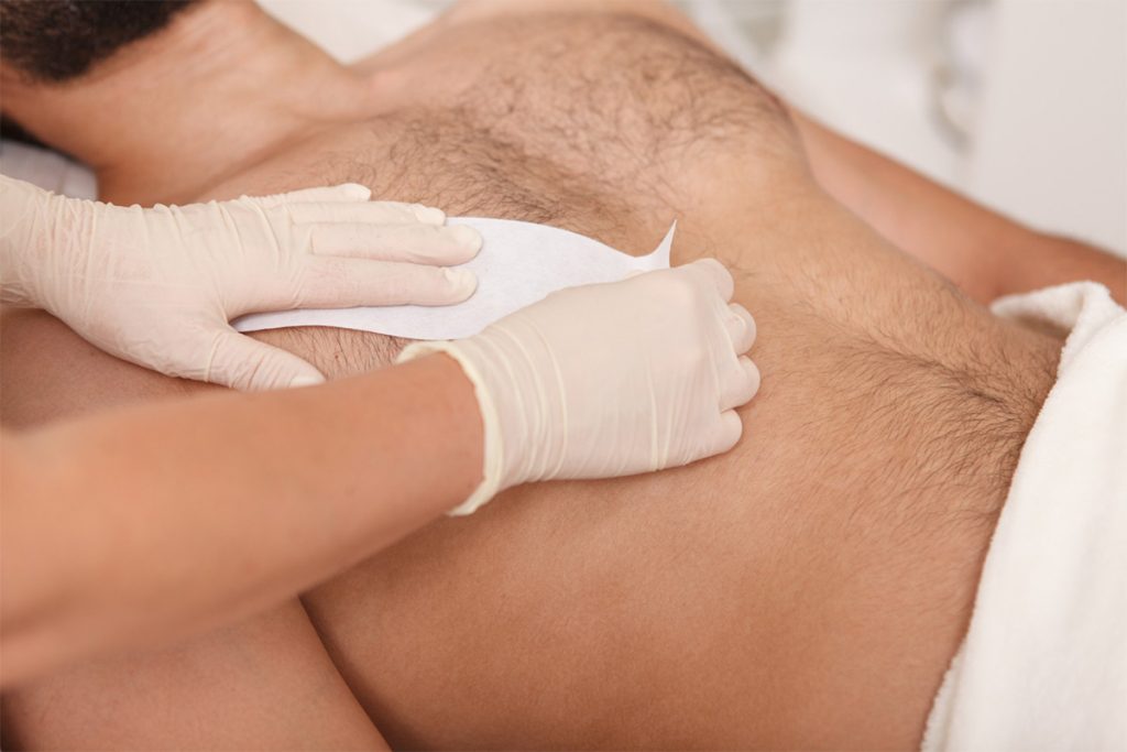 depilazione schiena uomo